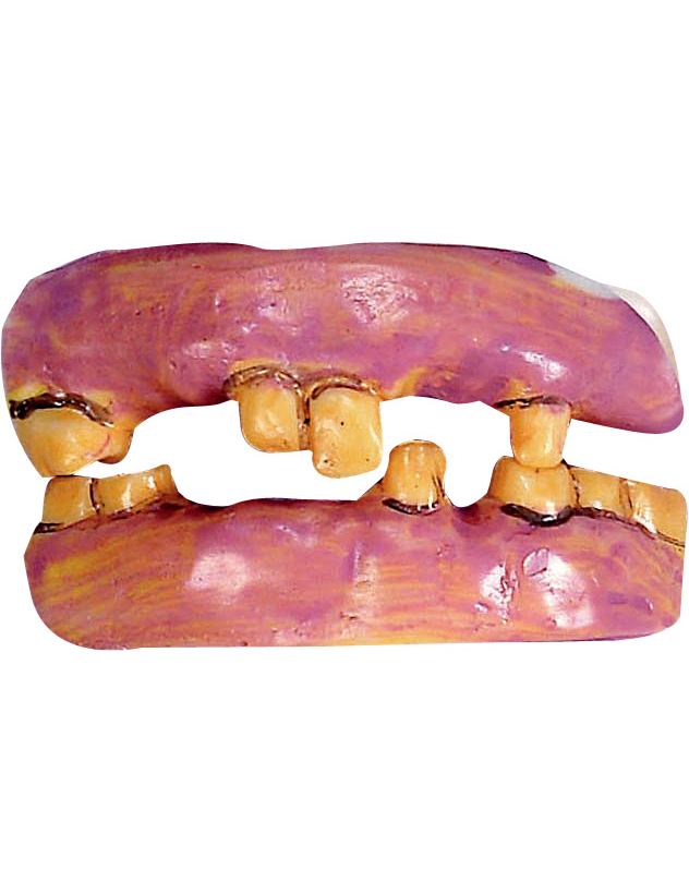 Dentier vieilles dents