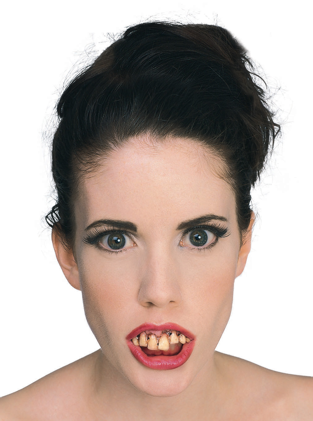 Dentier dents pourries