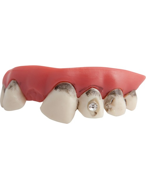 Dents sales avec faux diamants