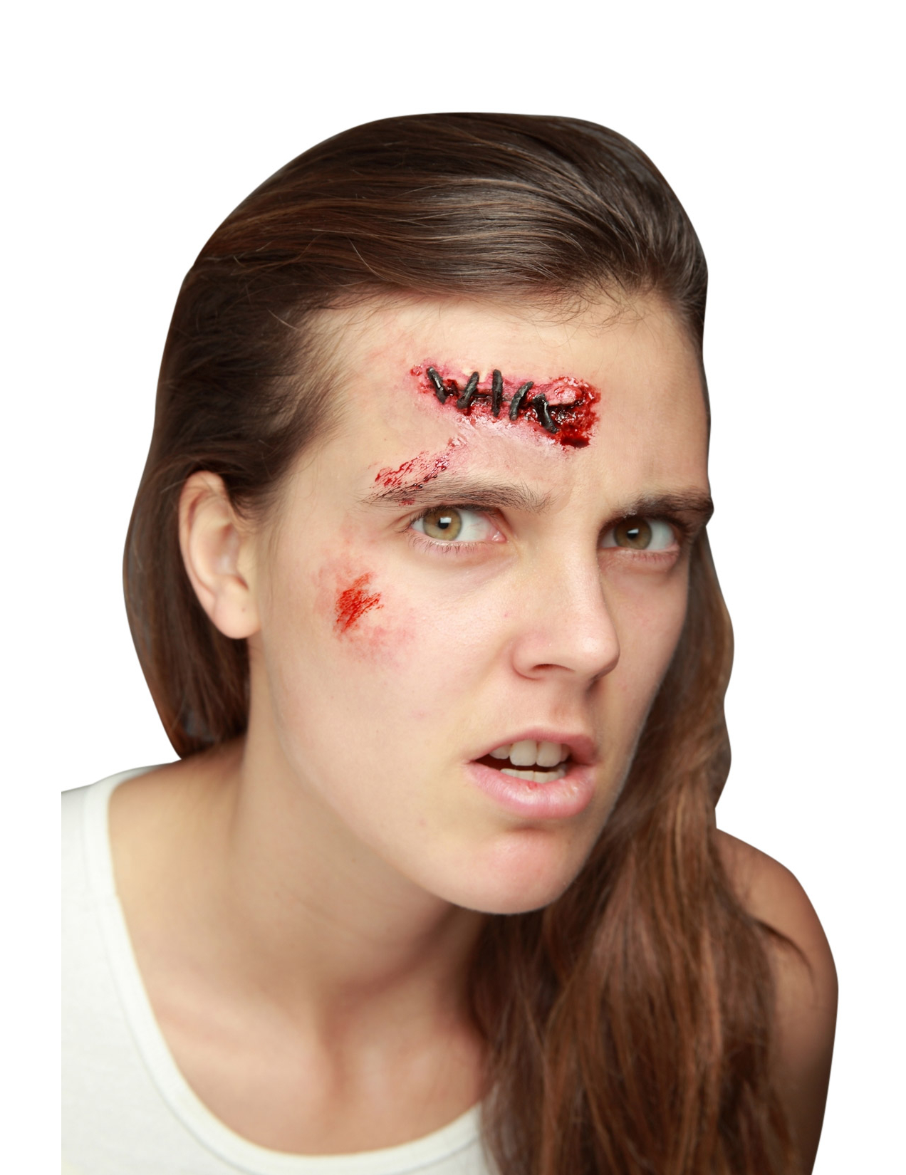 Fausse plaie avec points de suture