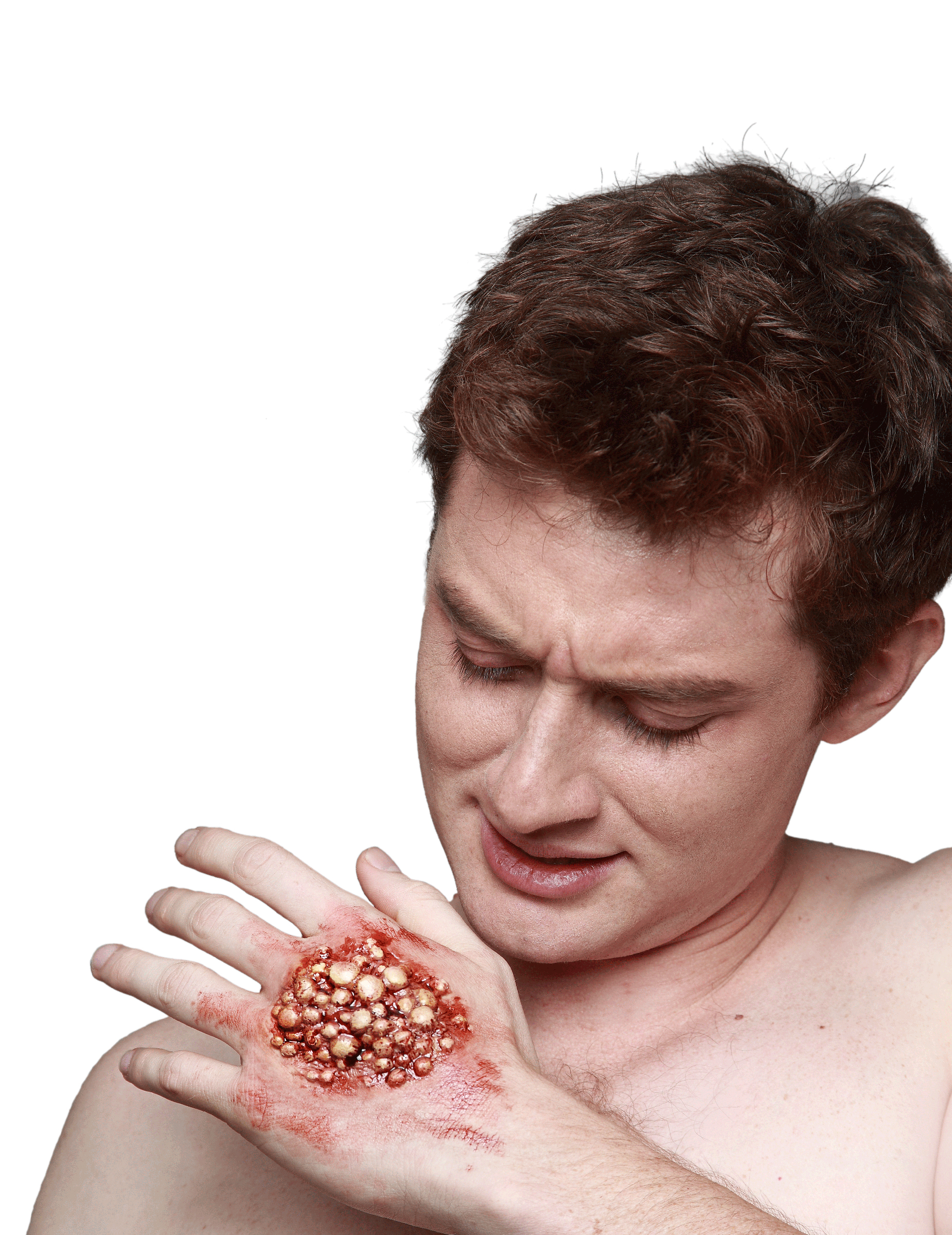 Fausse blessure pustules et cloques adultes Halloween